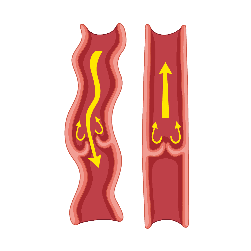 VenaSel